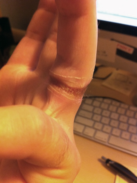 Wedding ring battery